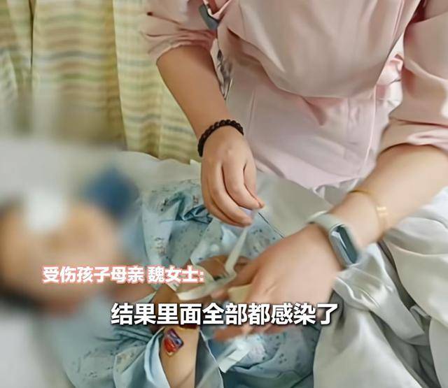 马耳他 vs 荷兰
_江西一5岁男孩在幼儿园被戳伤致左眼失明马耳他 vs 荷兰
，家长称老师用猪油涂抹试图消肿