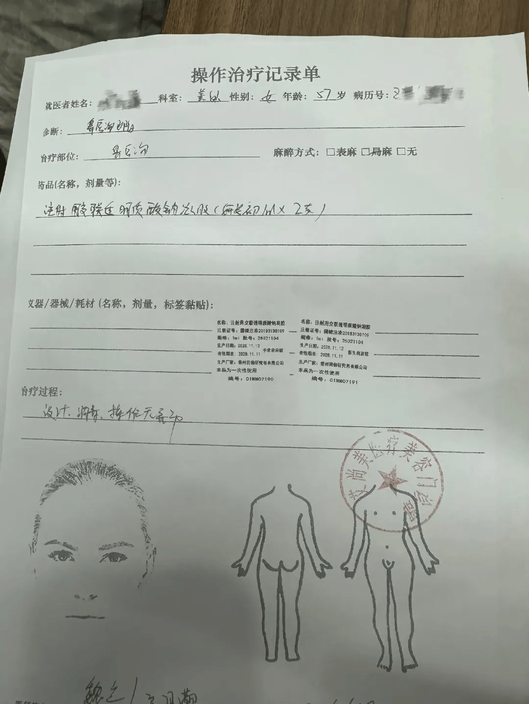 世界杯皇冠信用网代理_从600多元变成5万元世界杯皇冠信用网代理，广东57岁保洁员掏空积蓄做医美，双眼皮手术后眼睛红痛、视物模糊，当事人：销售像人贩子一样围着我；机构拒绝回应