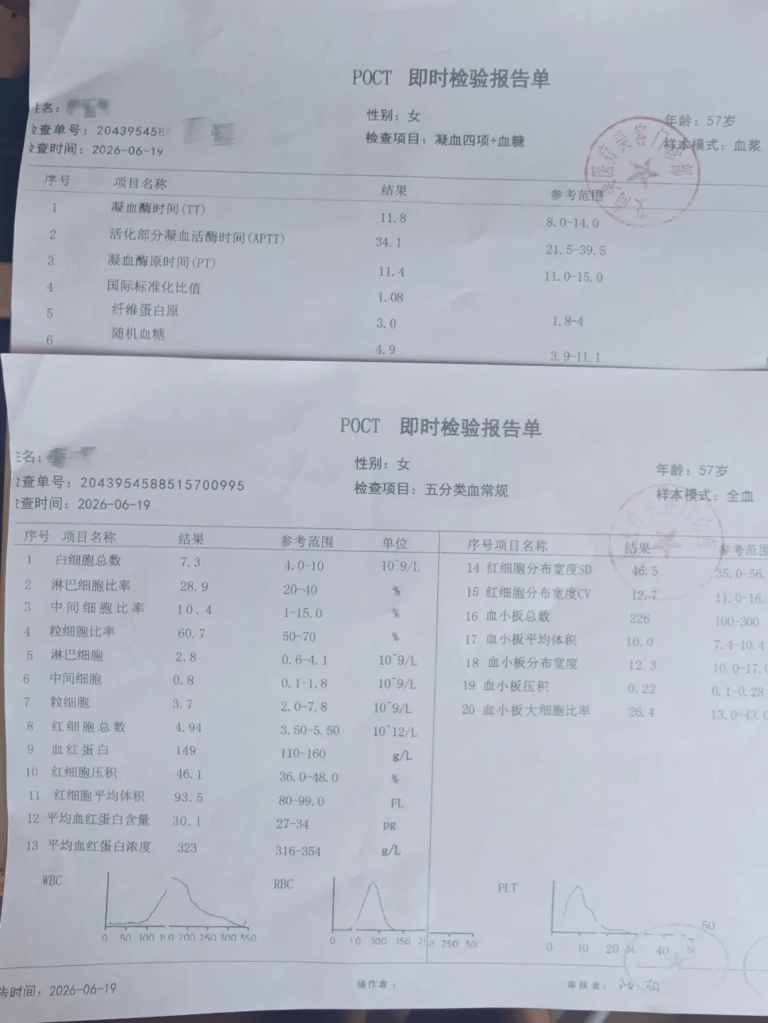 世界杯皇冠信用网代理_从600多元变成5万元世界杯皇冠信用网代理，广东57岁保洁员掏空积蓄做医美，双眼皮手术后眼睛红痛、视物模糊，当事人：销售像人贩子一样围着我；机构拒绝回应